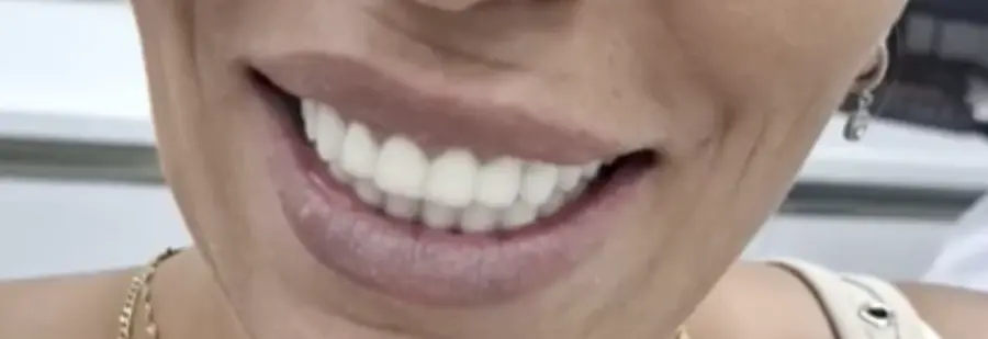 2025-07-30-9.24.45-ezgif.com-resize לפני ואחרי