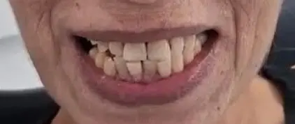 WhatsAppImage2025-07-22at17.28.40-ezgif.com-crop-2 לפני ואחרי