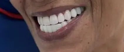 WhatsAppImage2025-07-22at17.28.40-ezgif.com-crop-3 לפני ואחרי