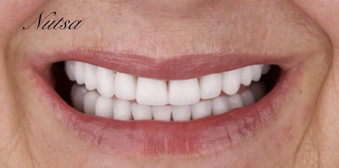 WhatsAppImage2025-07-30at06.20.09-ezgif.com-crop-1 לפני ואחרי