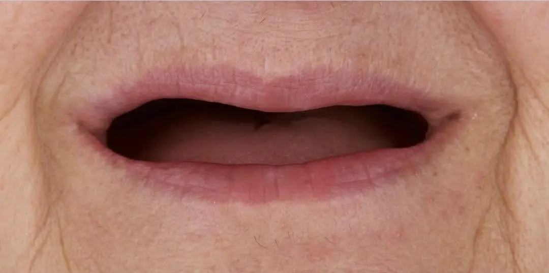 WhatsAppImage2025-07-30at06.20.09-ezgif.com-crop לפני ואחרי