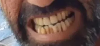 WhatsAppImage2025-07-30at07.08.31-ezgif.com-crop-1 לפני ואחרי