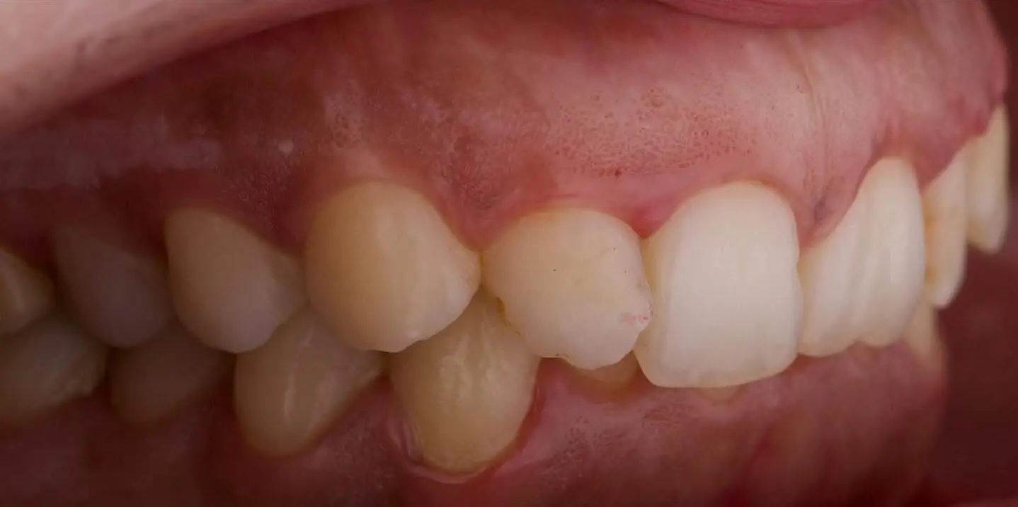 1-ezgif.com-crop-1 לפני ואחרי