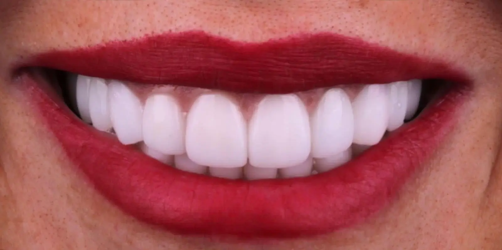 11-ezgif.com-crop-1 לפני ואחרי