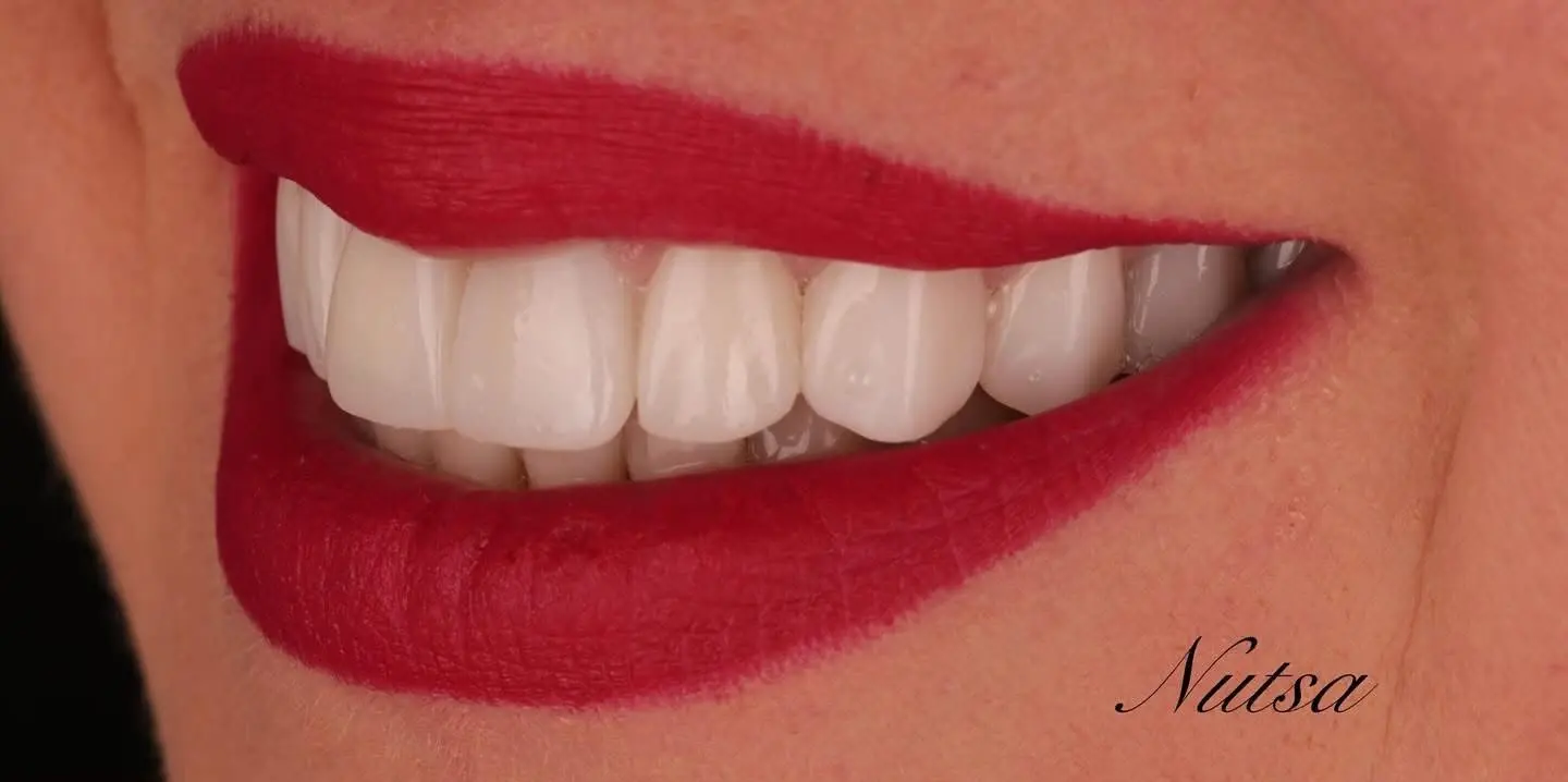 3-ezgif.com-crop לפני ואחרי