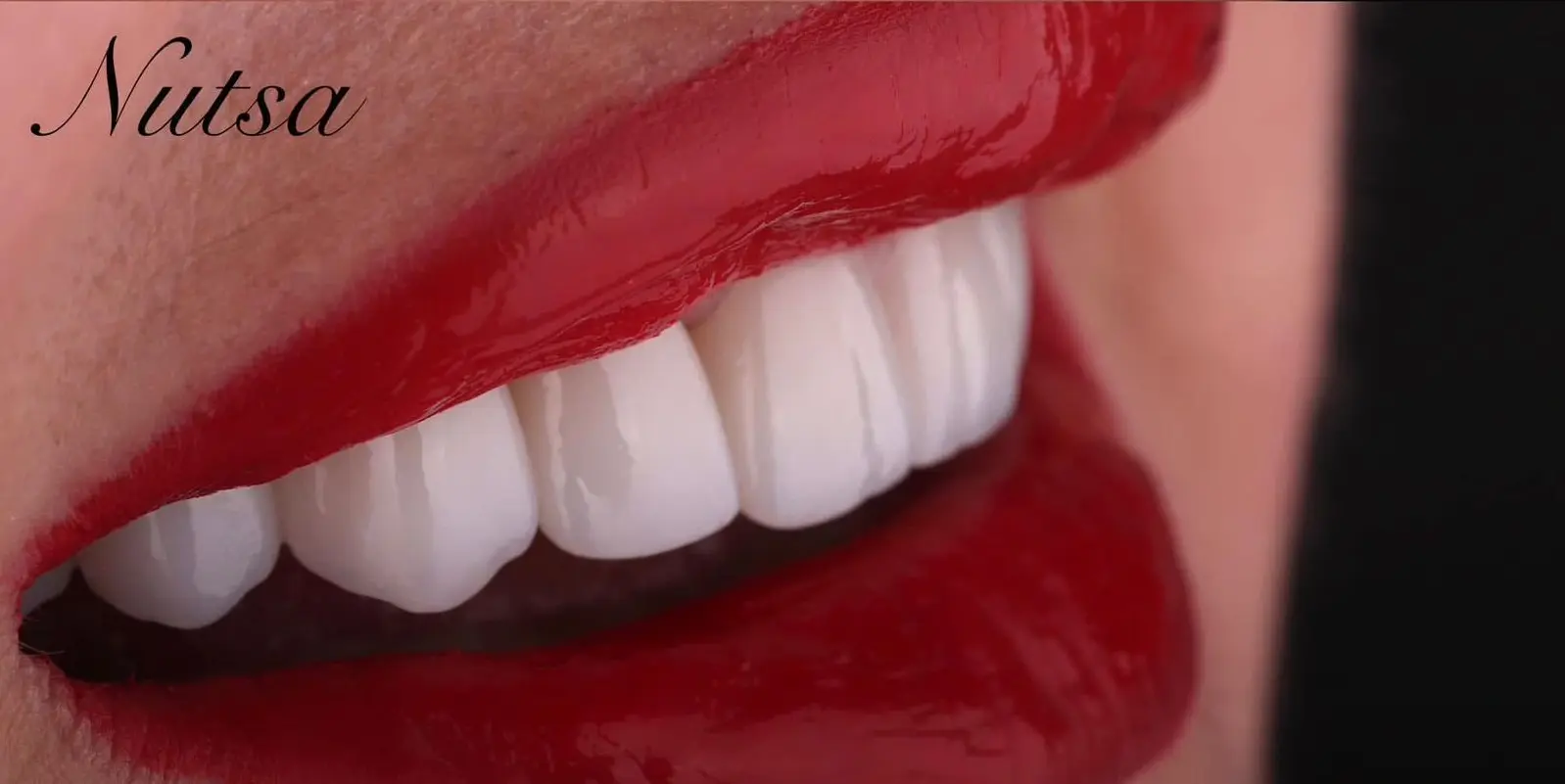 4-ezgif.com-crop-1 לפני ואחרי