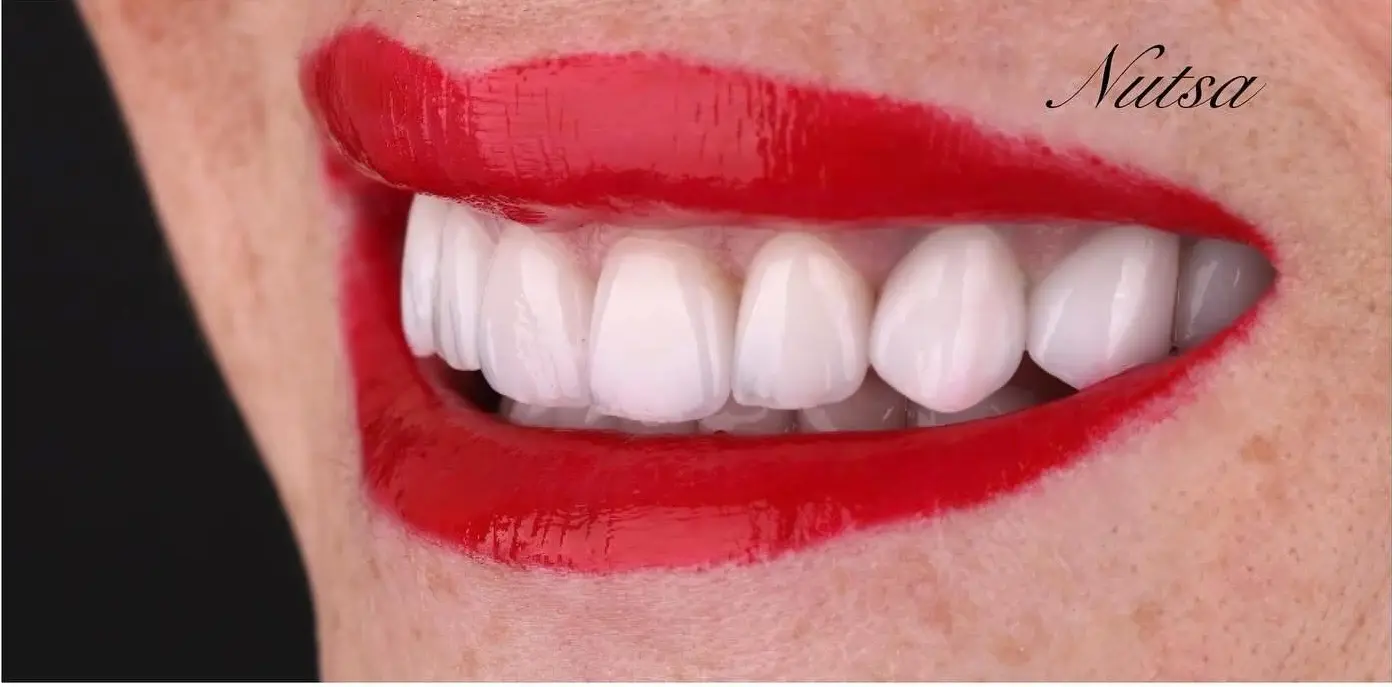 5-ezgif.com-crop-1 לפני ואחרי