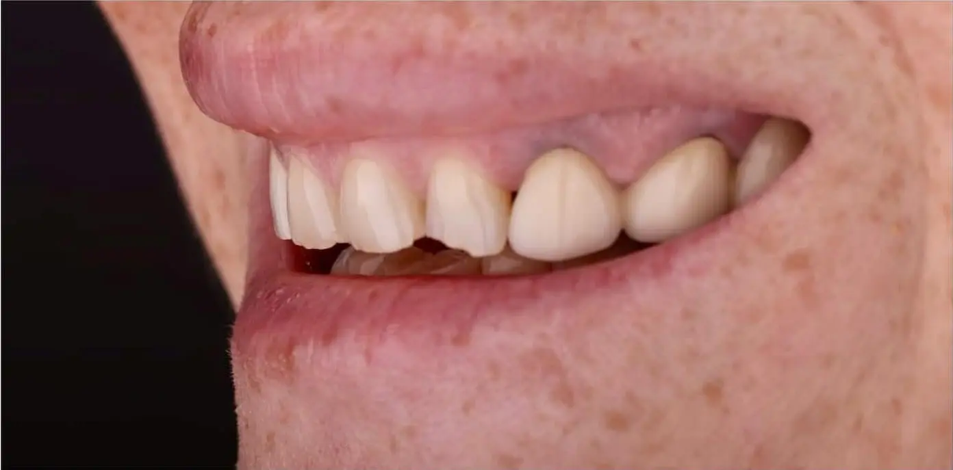 5-ezgif.com-crop לפני ואחרי