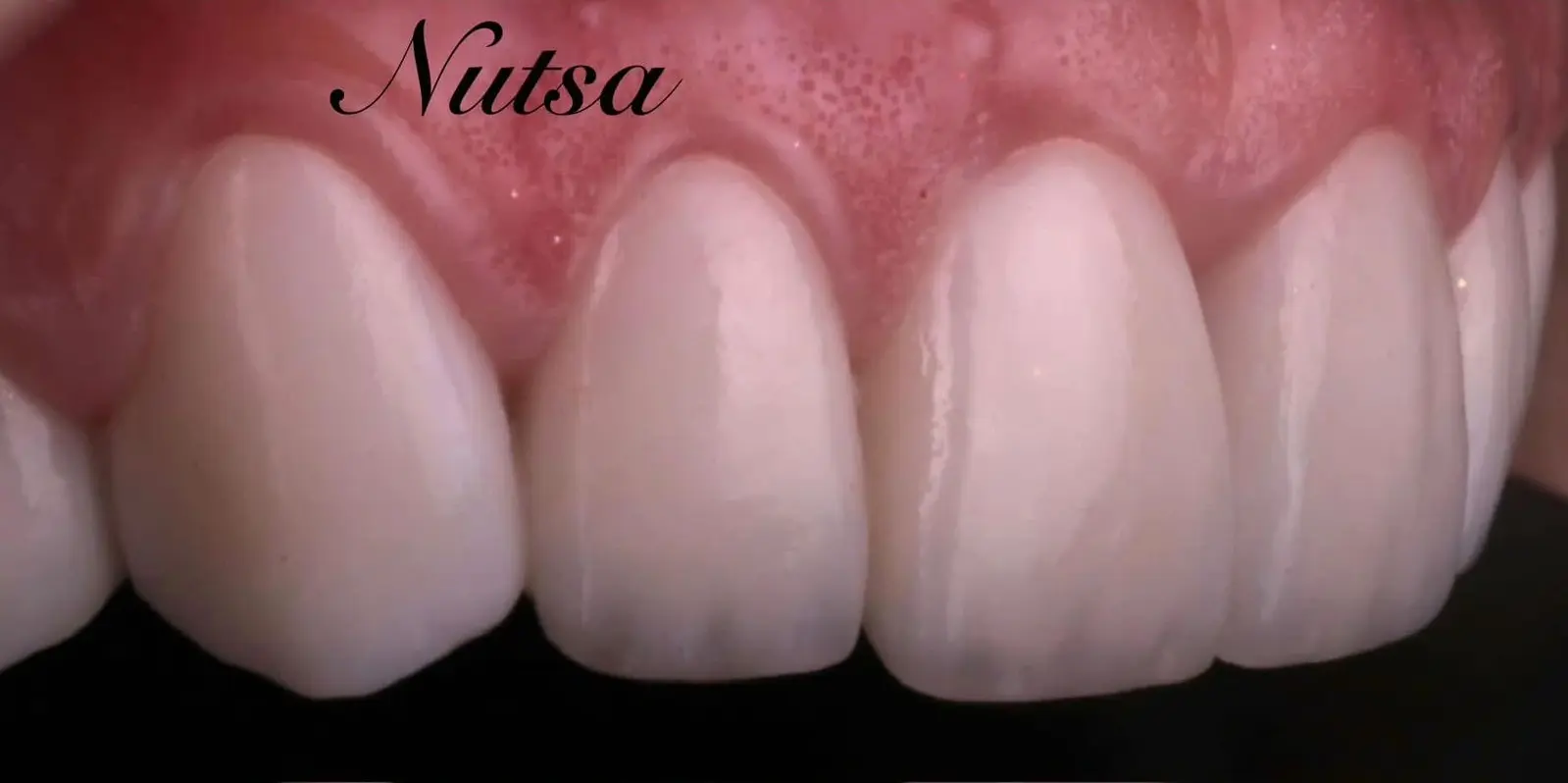 7-ezgif.com-crop-1 לפני ואחרי