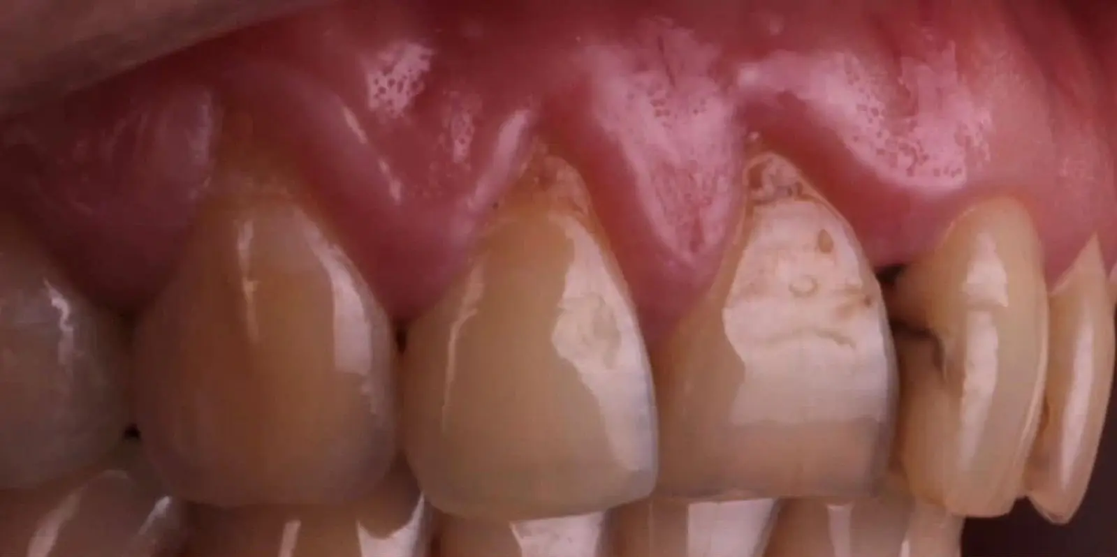 7-ezgif.com-crop לפני ואחרי