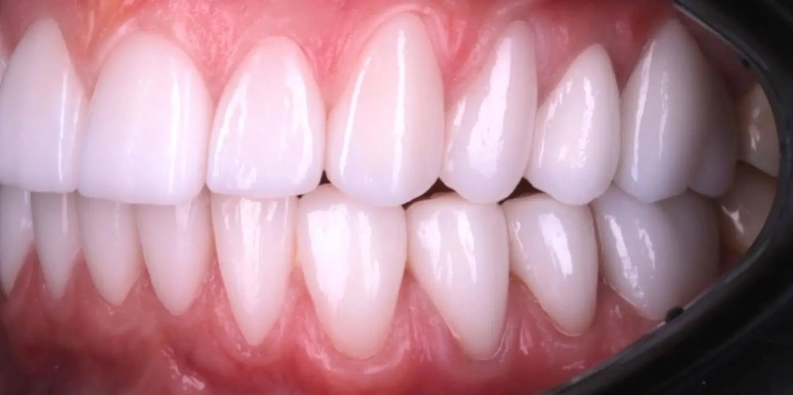 8-ezgif.com-crop-1 לפני ואחרי