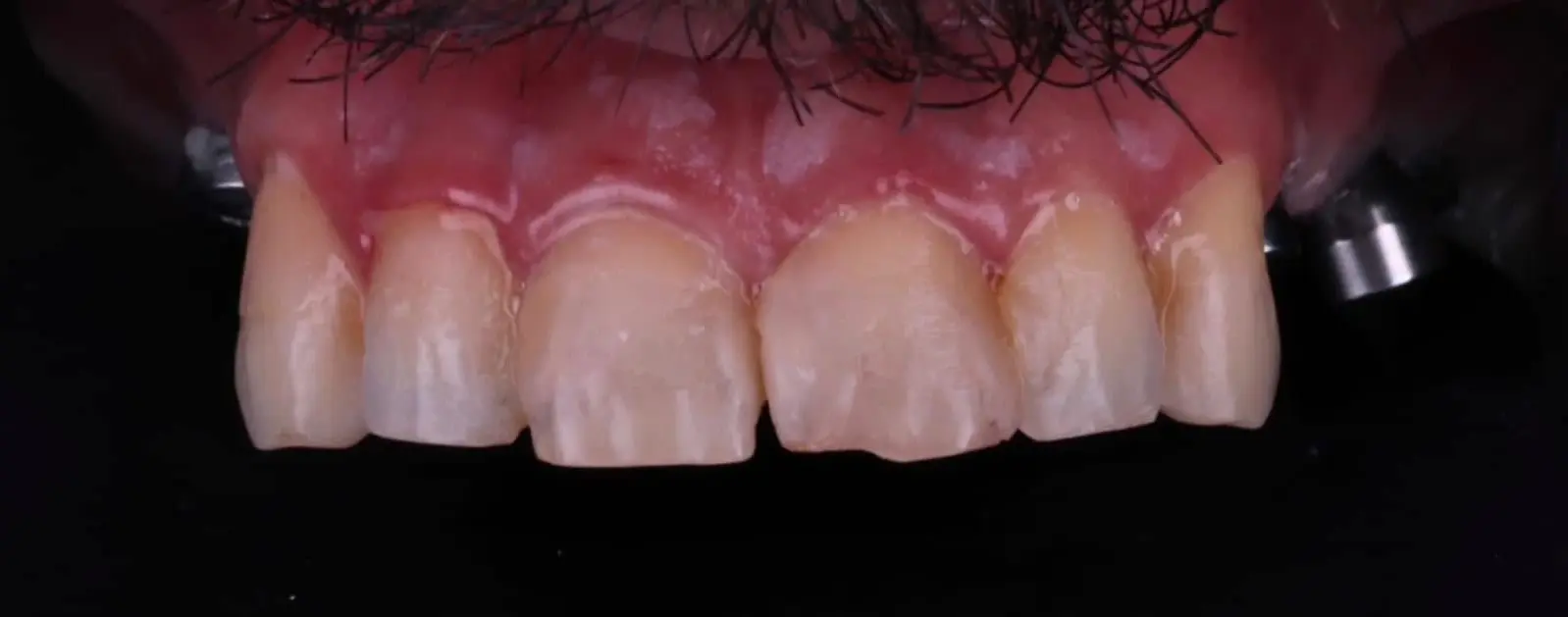 9-ezgif.com-crop לפני ואחרי